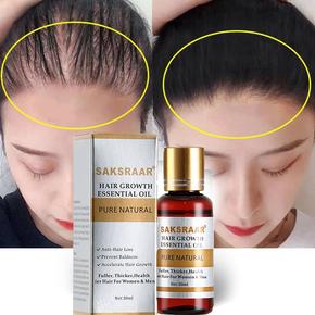 Falling Hair Oil